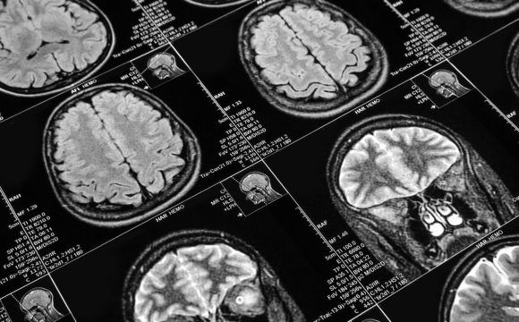Vital Imaging | Diagnostic Centers in Miami, Hialeah, Homestead